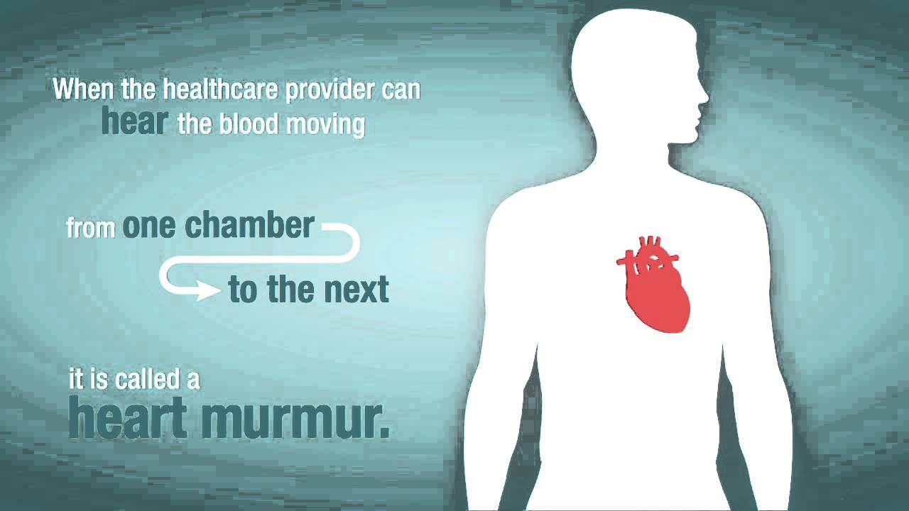 does adderall affect heart murmurs