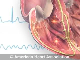 Why Is My Heart Beating So Fast? Causes, Home Remedies, and Red Flags