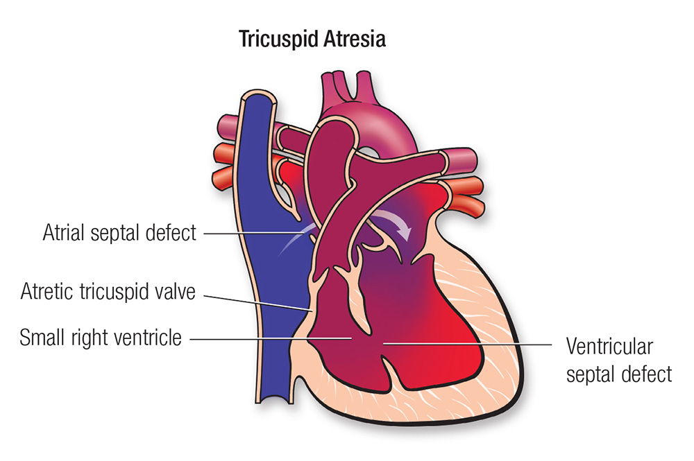 TA diagram