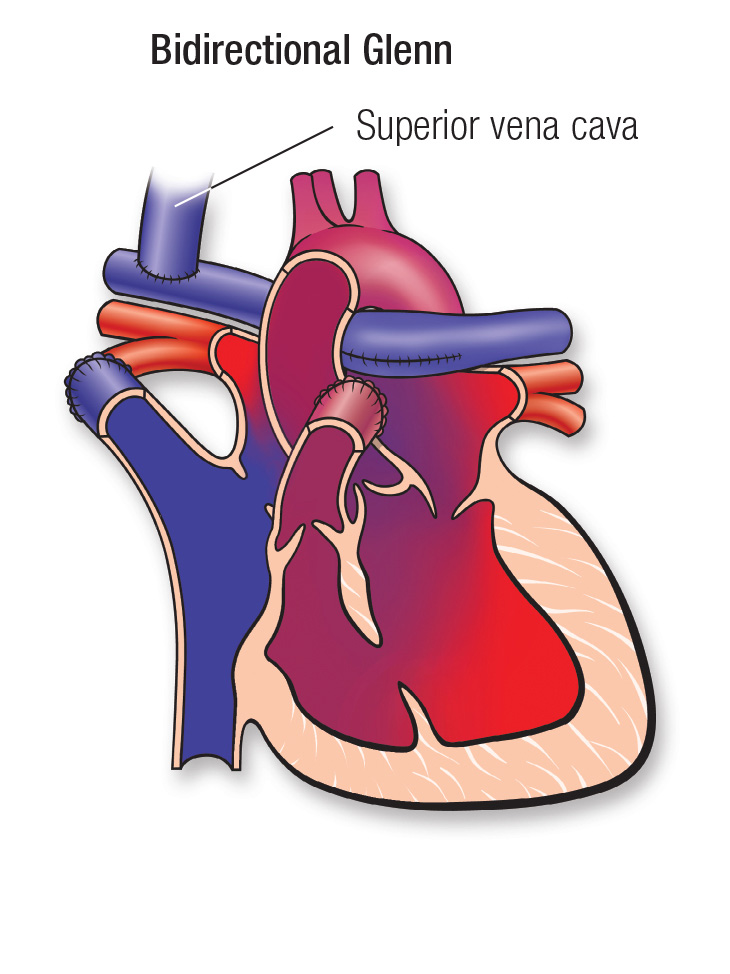 TA repair diagram