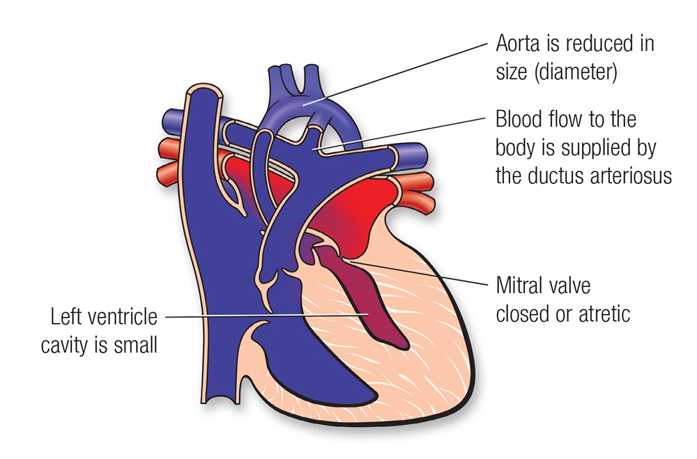 fetal heart anatomy