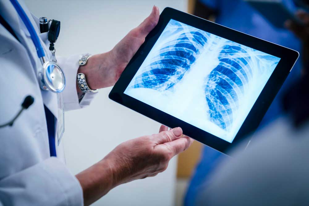 https://www.heart.org/-/media/Images/Health-Topics/Heart-Attack/Doctor-holding-image-of-chest-xray.jpg