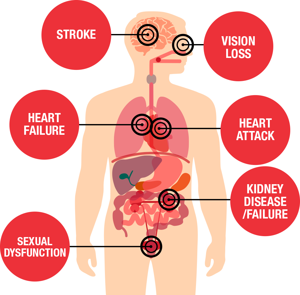 https://www.heart.org/-/media/Images/Health-Topics/High-Blood-Pressure/Health-threats-diagram.png