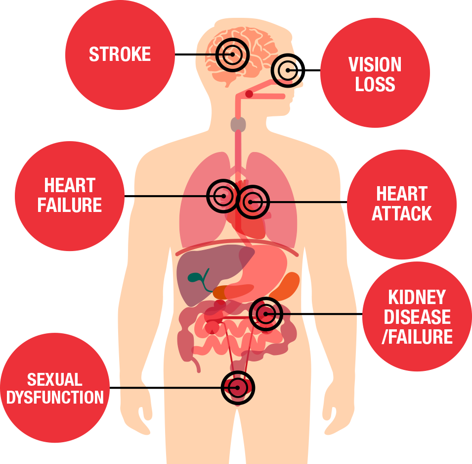 health-threats-from-high-blood-pressure-american-heart-association