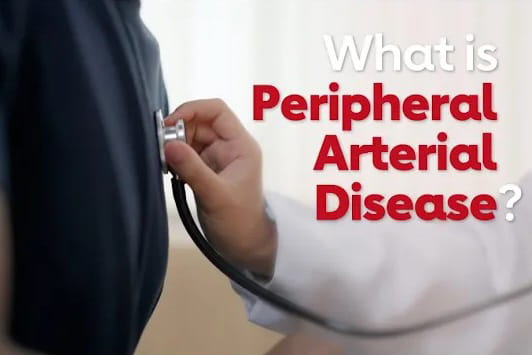 What is peripheral artery disease? video screenshot