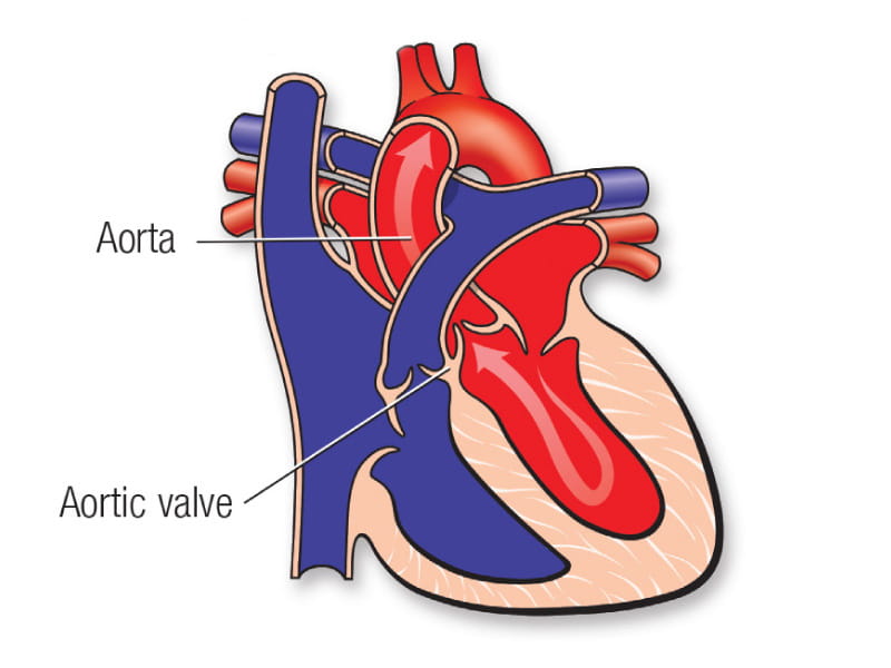 Death rates from tears in this major heart artery are rising ...