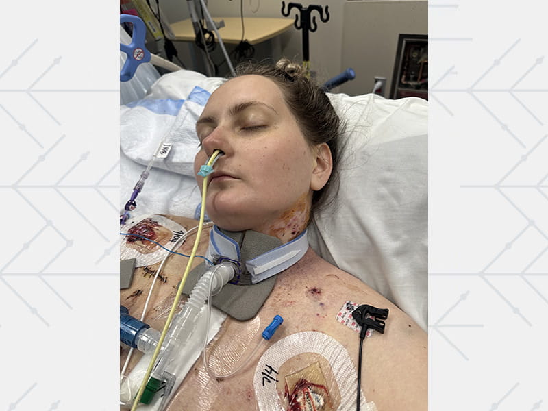 Alyssa Reader in the hospital connected to ECMO machines