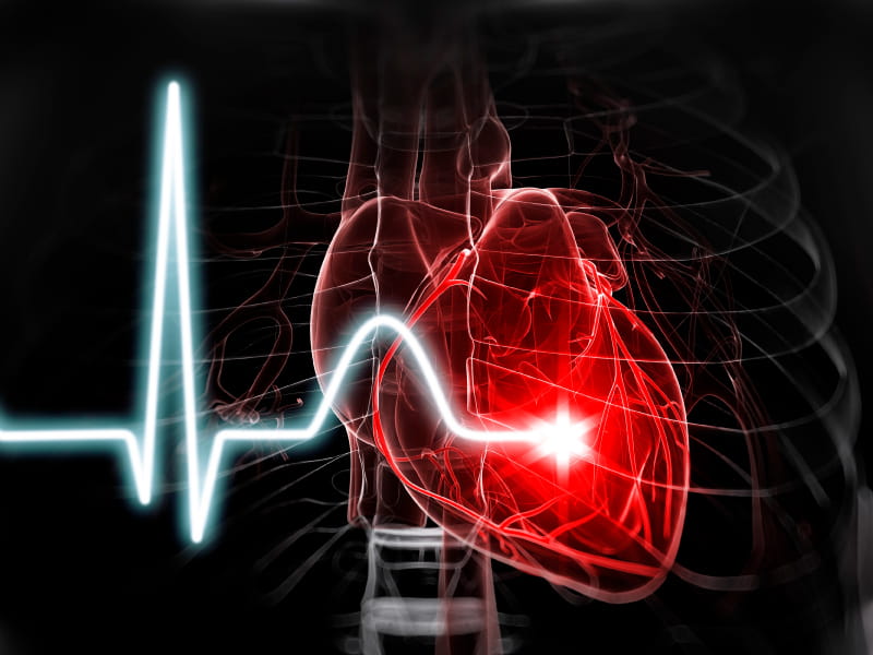 More Intense Blood Pressure Control May Lower Irregular Heartbeat Risk American Heart Association